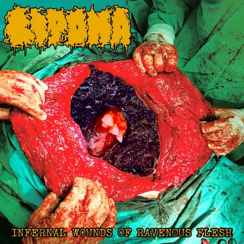 Lipoma / Infernal Wounds of Ravenous Flesh